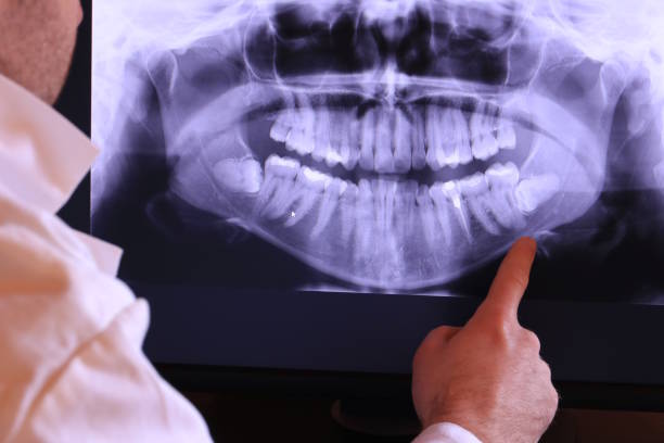 Best Emergency Dental Care for Broken or Chipped Teeth in Nth Bend, OR