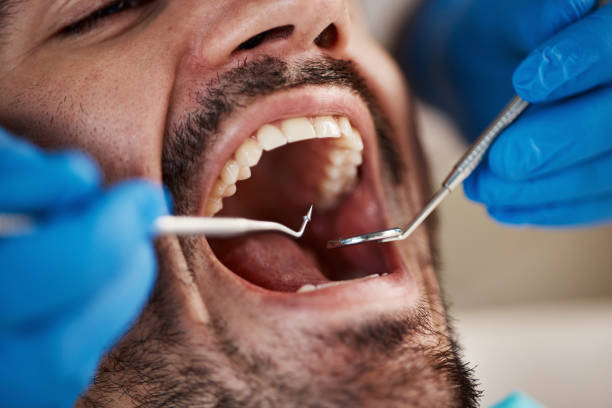 Best Pediatric Emergency Dentist in Nth Bend, OR