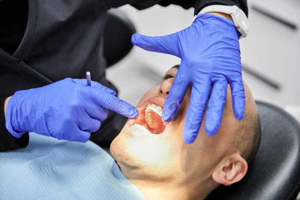Best Same-Day Emergency Dental Services in Nth Bend, OR
